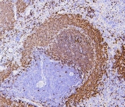 IHC staining of FFPE rat spleen with PAX5 antibody. HIER: boil tissue sections in pH6, 10mM citrate buffer, for 20 min and allow to cool before testing.
