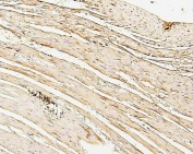 IHC staining of FFPE rat heart with SDHB antibody. HIER: boil tissue sections in pH6, 10mM citrate buffer, for 20 min and allow to cool before testing.