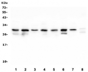 Western blot testing of human 1) HepG2, 2) K562, 3) ThP-1, 4) HEK293, 5) A549, 6) Caco-2, 7) rat RH35 and 8) mouse Neuro-2a lysate with COMT antibody. Predicted molecular weight: ~30/25 kDa (isoforms 1/2).