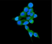 Immunofluorescent staining of FFPE human MCF7 cells with COMT antibody (green) and DAPI (blue). HIER: boil tissue sections in pH6, 10mM citrate buffer, for 20 min and allow to cool before testing.