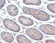 IHC staining of FFPE rat testis with COMT antibody. HIER: boil tissue sections in pH6, 10mM citrate buffer, for 20 min and allow to cool before testing.