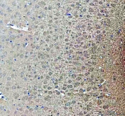 IHC staining of FFPE mouse brain tissue with NOTCH2 antibody. HIER: boil tissue sections in pH8 EDTA for 20 min and allow to cool before testing.