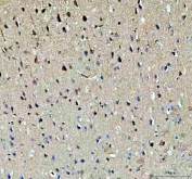 IHC staining of FFPE rat brain tissue with NOTCH2 antibody. HIER: boil tissue sections in pH8 EDTA for 20 min and allow to cool before testing.