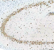 IHC staining of FFPE rat hippocampus tissue with Fox2 antibody. HIER: boil tissue sections in pH8 EDTA for 20 min and allow to cool before testing.
