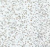 IHC staining of FFPE rat brain cortex tissue with Fox2 antibody. HIER: boil tissue sections in pH8 EDTA for 20 min and allow to cool before testing.