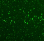 Immunofluorescent staining of FFPE mouse brain tissue with Fox2 antibody (green). HIER: steam section in pH8 EDTA buffer for 20 min.