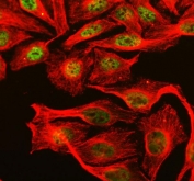 Immunofluorescent staining of FFPE human U-2 OS cells with Fox antibody (green) and Alpha Tubulin mAb (red). HIER: steam section in pH6 citrate buffer for 20 min.