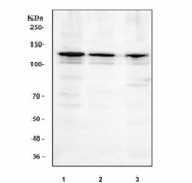 Western blot testing of human 1) SiHa, 2) A549 and 3) Caco-2 cell lysate with SIRT1 antibody. Predicted molecular weight ~80 kDa but is routinely observed at 110~120 kDa due to post-translational modification.
