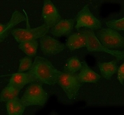 Immunofluorescent staining of FFPE human HeLa cells with SIRT1 antibody (red) and Beta Tubulin mAb (green). HIER: boil tissue sections in pH6, 10mM citrate buffer, for 20 min and allow to cool before testing.