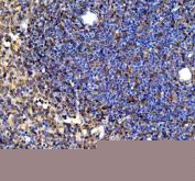 IHC staining of FFPE mouse spleen tissue with SYK antibody, HRP-secondary and DAB substrate. HIER: boil tissue sections in pH8 EDTA for 20 min and allow to cool before testing.