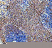 IHC staining of FFPE rat spleen tissue with SYK antibody, HRP-secondary and DAB substrate. HIER: boil tissue sections in pH8 EDTA for 20 min and allow to cool before testing.