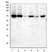 Western blot testing of 1) human ThP1, 2) human HEL, 3) human A431, 4) human RT4, 5) rat spleen and 6) mouse RAW264.7 cell lysate with SYK antibody. Predicted molecular weight ~72 kDa.