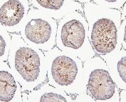 IHC staining of FFPE rat testis with TIE2 antibody. HIER: boil tissue sections in pH6, 10mM citrate buffer, for 20 min and allow to cool before testing.