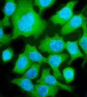 Immunofluorescent staining of FFPE human Caco-2 cells with Aldolase B antibody (green) and DAPI nuclear stain (blue). HIER: steam section in pH6 citrate buffer for 20 min.