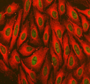 Immunofluorescent staining of FFPE human U-2 OS cells with TORC1 antibody (green) and Alpha Tubulin mAb (red). HIER: steam section in pH6 citrate buffer for 20 min.