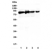 Western blot testing of 1) rat PC-12, 2) rat liver, 3) mouse liver and 4) human SHG-44 lysate with DBH antibody. Predicted molecular weight ~69 kDa.