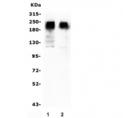 Western blot testing of 1) rat brain and 2) mouse brain lysate with GRM2 antibody. Predicted molecular weight ~96 kDa, routinely observed at 110-120 kDa (monomer) and 220-240 kDa (dimer).