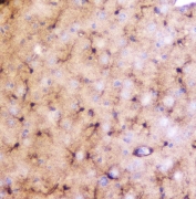 IHC staining of FFPE mouse brain with LRTOMT antibody. HIER: boil tissue sections in pH6, 10mM citrate buffer, for 20 min and allow to cool before testing.