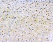 IHC staining of FFPE rat brain with LRTOMT antibody. HIER: boil tissue sections in pH6, 10mM citrate buffer, for 20 min and allow to cool before testing.