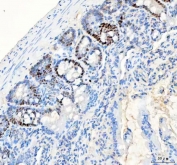 IHC staining of FFPE rat colon tissue with PCNA antibody. HIER: boil tissue sections in pH8 EDTA for 20 min and allow to cool before testing.