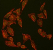 Immunofluorescent staining of FFPE human U-2 OS cells with SUZ12 antibody (green) and Beta Tubulin mAb (red). HIER: steam section in pH6 citrate buffer for 20 min.