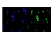 Immunofluorescent staining of FFPE human A431 cells with UBC9 antibody (green) and DAPI nuclear stain (blue). HIER: steam section in pH6 citrate buffer for 20 min.
