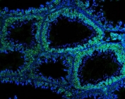 Immunofluorescent staining of FFPE rat testis tissue with DDX4 antibody (green) and DAPI nuclear stain (blue). HIER: steam section in pH8 EDTA for 20 min.