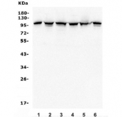 Western blot testing of human 1) HeLa, 2) HEK293, 3) U-2 OS, 4) U-87 MG, 5) rat PC-12 and 6) mouse NIH 3T3 lysate with Alpha 1 Catenin antibody. Predicted molecular weight ~102 kDa.
