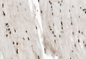 IHC staining of FFPE mouse skeletal muscle with NFIC antibody. HIER: boil tissue sections in pH8 EDTA for 20 min and allow to cool before testing.
