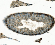 IHC staining of FFPE mouse testis with Enolase 1 antibody. HIER: boil tissue sections in pH8 EDTA for 20 min and allow to cool before testing.