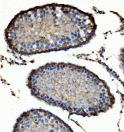 IHC staining of FFPE rat testis with Enolase 1 antibody. HIER: boil tissue sections in pH8 EDTA for 20 min and allow to cool before testing.