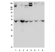 Western blot testing of rat 1) brain, 2) heart, 3) kidney, 4) liver, and mouse 5) brain, 6) kidney, 7) liver and 8) RAW264.7 lysate with Enolase 1 antibody. Predicted molecular weight ~47 kDa.