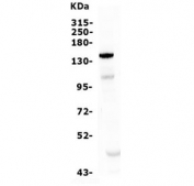 Western blot testing of human ThP-1 lysate with Patched 2 antibody. Expected molecular weight ~130 kDa.