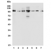 Western blot testing of 1) human K562, 2) human Raji, 3) rat C6, 4) mouse NIH 3T3, 5) human HepG2, 6) human A549 and 7) human ThP-1 lysate with AIP4 antibody. Predicted molecular weight: ~99 kDa.