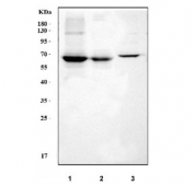 Western blot testing of 1) human A549, 2) human K562 and 3) mouse kidney tissue lysate with GRB7 antibody. Predicted molecular weight: 60 kDa.