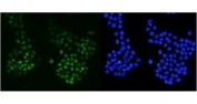 Immunofluorescent staining of FFPE human A431 cells with MSH6 antibody (green) and DAPI nuclear stain (blue). HIER: steam section in pH6 citrate buffer for 20 min.