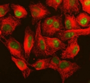 Immunofluorescent staining of FFPE human A549 cells with MSH6 antibody (green) and Alpha Tubulin mAb (red). HIER: steam section in pH6 citrate buffer for 20 min.
