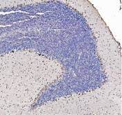IHC staining of FFPE rat brain tissue with SHANK3 antibody. HIER: boil tissue sections in pH8 EDTA for 20 min and allow to cool before testing.