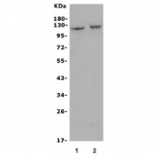 Western blot testing of mouse 1) RAW264.7 and 2) ANA-1 cell lysate with TNFRSF8 antibody. Predicted molecular weight: 53-120 kDa depending on glycosylation level.