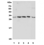 Western blot testing of 1) rat lung, 2) mouse brain, 3) mouse heart, 4) mouse lung and 5) human HepG2 lysate with ULBP1 antibody. Predicted molecular weight ~28 kDa but may be observed at higher molecular weights due to glycosylation.