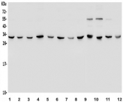 Western blot testing of human 1) HeLa, 2) Jurkat, 3) HepG2, 4) SH-SY5Y, 5) HEK293, 6) SW620, 7) A549, 8) Raji, 9) rat brain, 10) mouse brain, 11) mouse NIH 3T3 and 12) mouse RAW264.7 lysate with 14-3-3 epsilon antibody. Predicted molecular weight ~28 kDa.