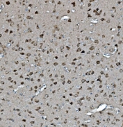 IHC staining of FFPE rat brain with 14-3-3 epsilon antibody. HIER: boil tissue sections in pH8 EDTA for 20 min and allow to cool before testing.