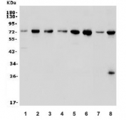 Western blot testing of human 1) HL-60, 2) HEK293, 3) ThP-1, 4) HeLa, 5) Raji, 6) K562, 7) rat spleen, 8) mouse RAW264.7 lysate with ZBTB16 antibody. Predicted molecular weight: 74-81 kDa.