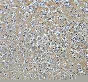 IHC staining of FFPE human liver tissue with ACADSB antibody, HRP-secondary and DAB substrate. HIER: boil tissue sections in pH8 EDTA for 20 min and allow to cool before testing.
