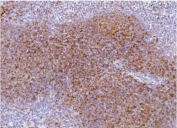 IHC staining of FFPE mouse spleen with Cd2 antibody. HIER: boil tissue sections in pH8 EDTA for 20 min and allow to cool before testing.