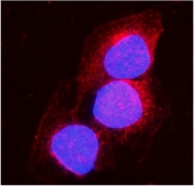 Immunofluorescent staining of FFPE human A431 cells with ACO1 antibody (red) and DAPI nuclear stain (blue). HIER: steam section in pH6 citrate buffer for 20 min.
