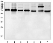 Western blot testing of 1) human U-2 OS, 2) human HeLa, 3) human HepG2, 4) rat NRK, 5) rat lung, 6) mouse stomach and 7) mouse NIH 3T3 cell lysate with ALAS1 antibody. Predicted molecular weight ~71 kDa.