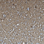 IHC staining of FFPE rat brain with GAP43 antibody. HIER: boil tissue sections in pH8 EDTA for 20 min and allow to cool before testing.