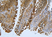 IHC staining of FFPE rat intestine with ApoER2 antibody. HIER: boil tissue sections in pH8 EDTA for 20 min and allow to cool before testing.