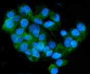Immunofluorescent staining of FFPE human HepG2 cells with ApoER2 antibody (green) and DAPI nuclear stain (blue). HIER: steam section in pH6 citrate buffer for 20 min.